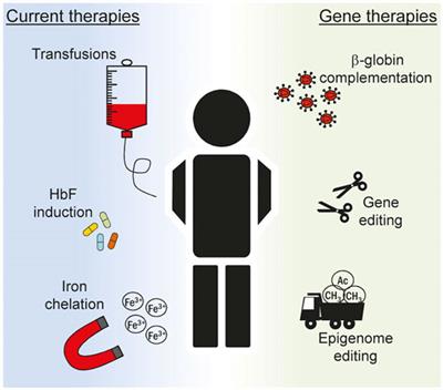 Recent Approaches for Manipulating Globin Gene Expression in Treating Hemoglobinopathies